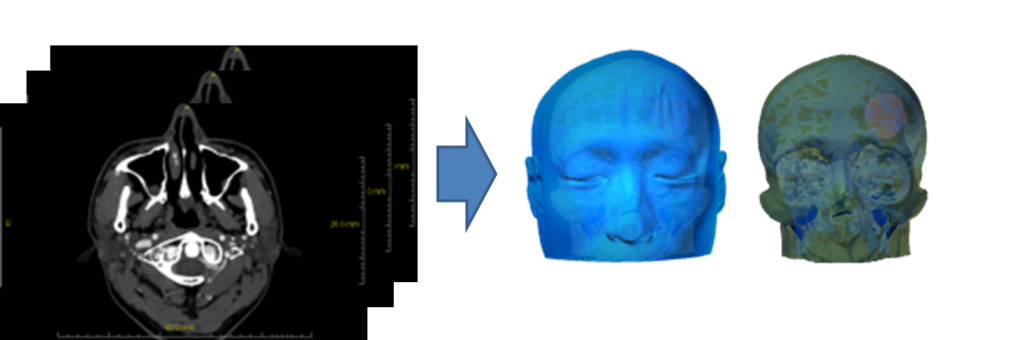 dicom-to-3dmodel
